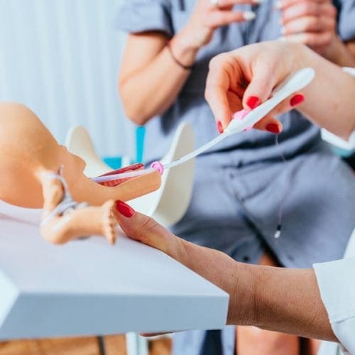 3 Tahap Inseminasi Buatan IUI untuk Gangguan Infertilitas
