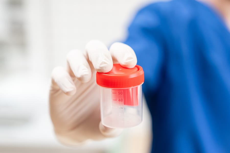 Teratozoospermia Adalah Kelainan Sperma: Kenali Penanganannya