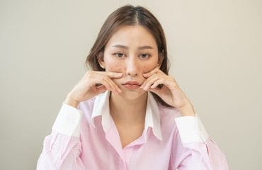 lupus pada ibu hamil