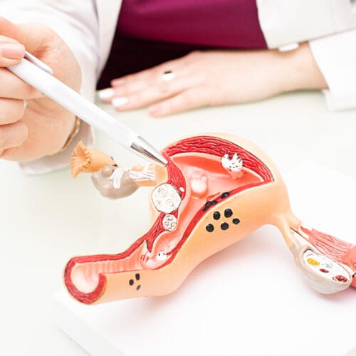 Endometrium: Bagian, Fungsi, dan Jenis Gangguan