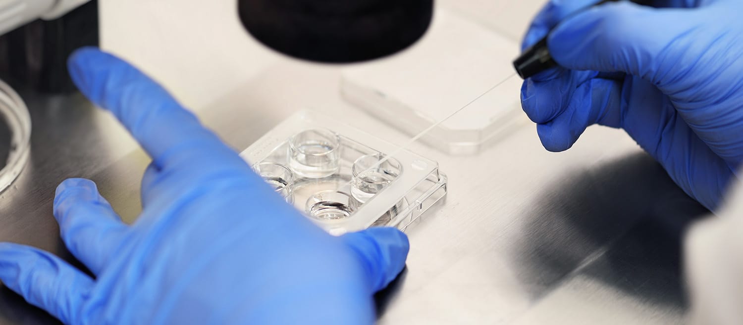 pemeriksaan kesuburan