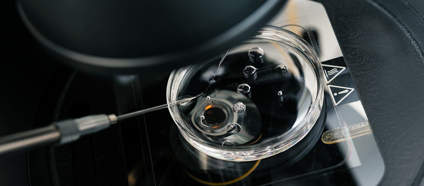 Intrauterine Insemination (IUI)