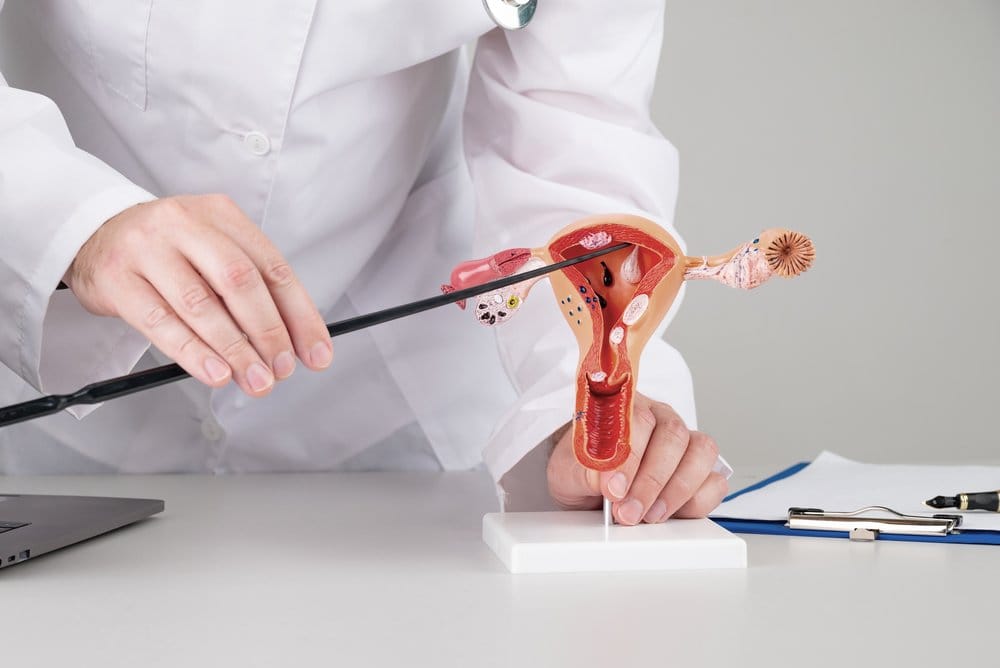 Perbedaan PCO dan PCOS