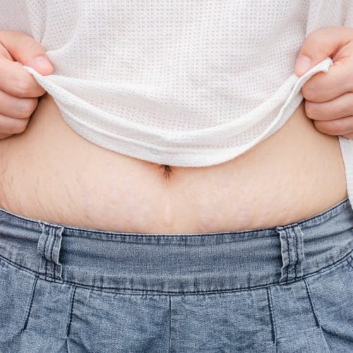 7 Ciri-Ciri Fisik Orang Hamil yang Umum hingga Jarang Disadari 