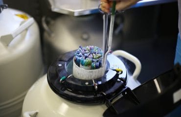 Frozen Embryo Transfer