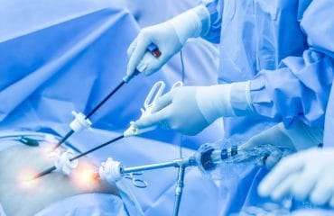 Laparoskopi untuk Program Hamil