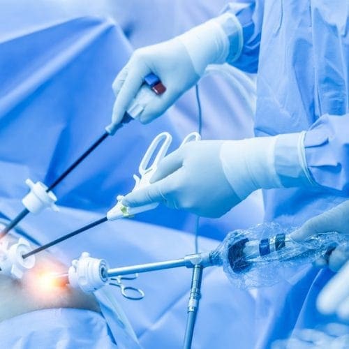Prosedur Laparoskopi untuk Program Hamil dan Manfaatnya