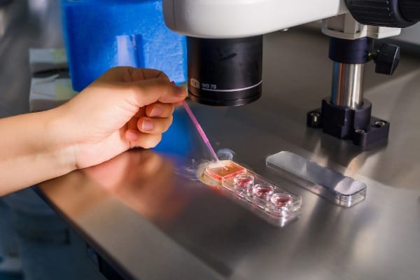 Teknologi Reproduksi Berbantu