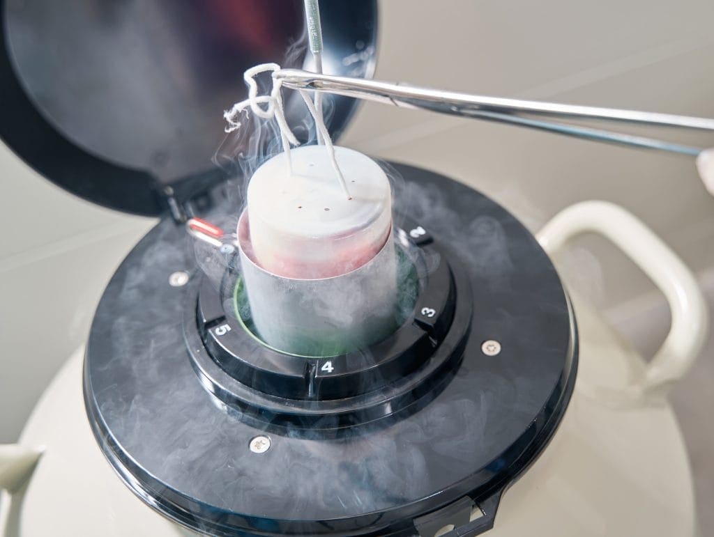 Cek Kelebihan & Kekurangan Pembekuan Sel Telur (Egg Freezing)