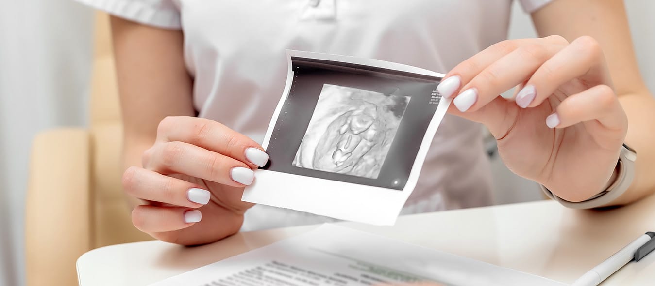 prp ovarium prp ovarium