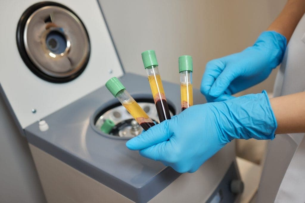 Platelets Rich Plasma (PRP) Ovarium pada Sistem Reproduksi