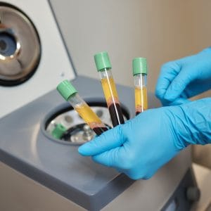Platelets Rich Plasma (PRP) Ovarium pada Sistem Reproduksi