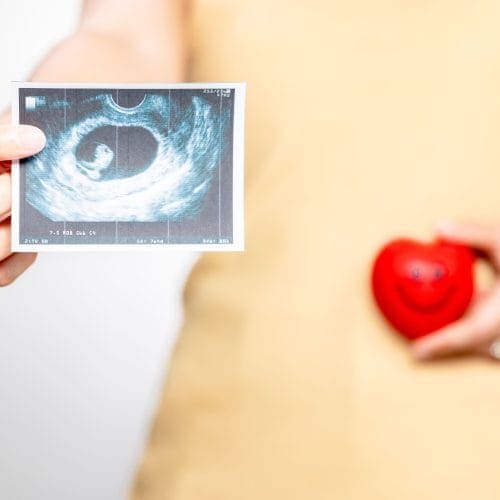 FAQ Bayi Tabung yang Sering Ditanyakan
