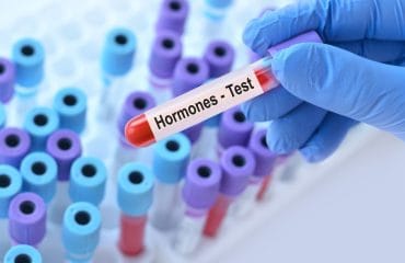 Tes hormon reproduksi wanita