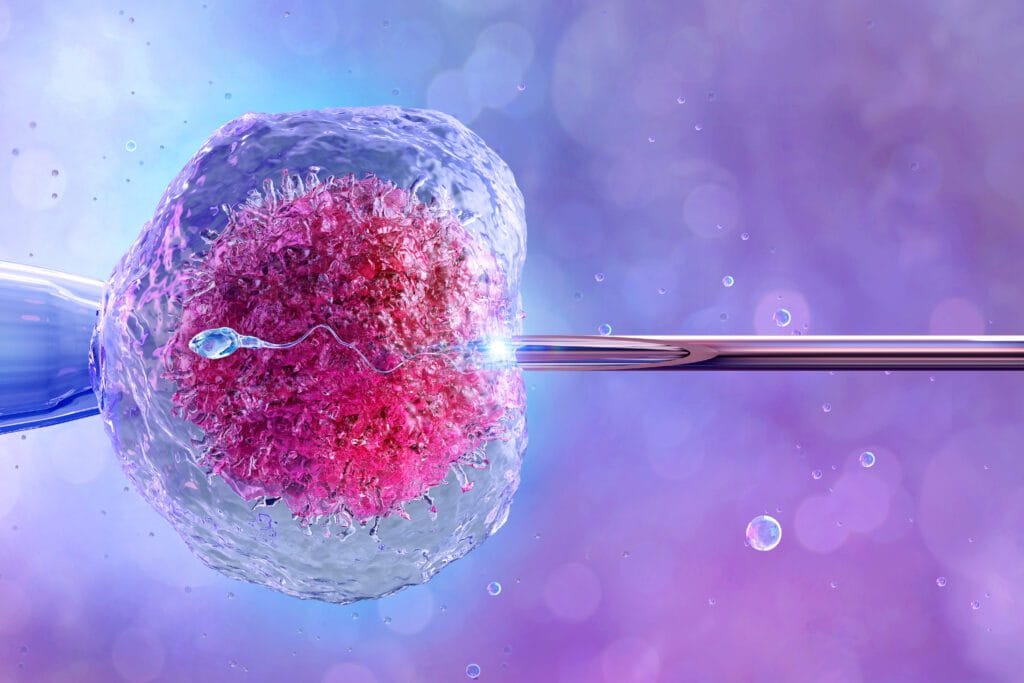Tujuan Inseminasi Buatan (IUI) dalam Program Hamil