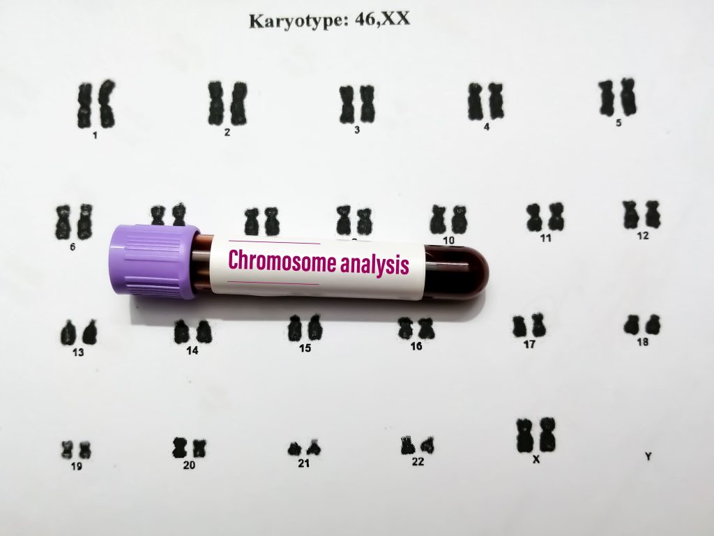 Mengenal Tes Karyotyping untuk Medekteksi Kelainan Genetik