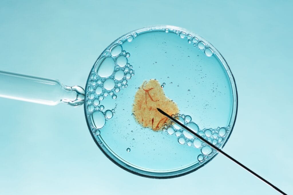 Inilah Kisaran Biaya Inseminasi Buatan