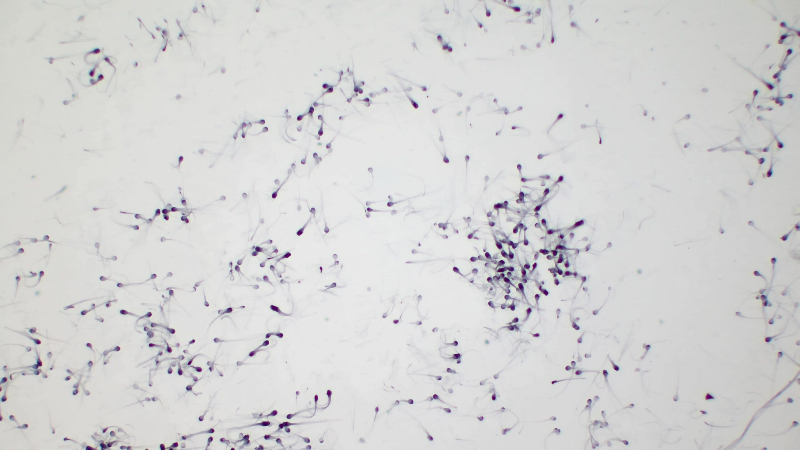 Physiological Intracytoplasmic Sperm Injection