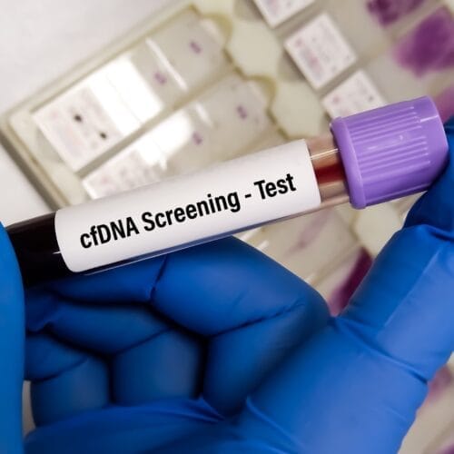 Tes Prenatal Cell-Free DNA (cfDNA) dan Prosedurnya