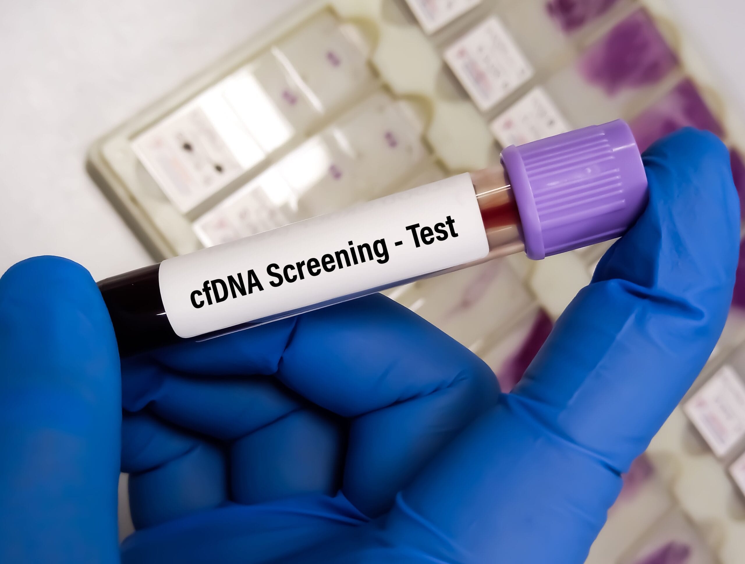 cell free DNA screening