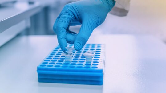 Preimplantation Genetic Testing