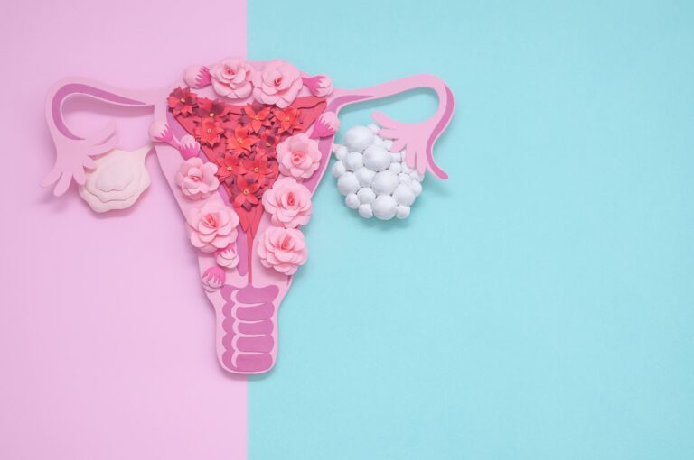 Penanganan PCOS & Kesuburan